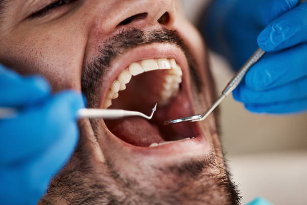 Best Emergency Dental Care for Sports Injuries in Northwest Harbor, NY